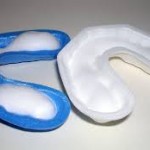 Fluoride Application